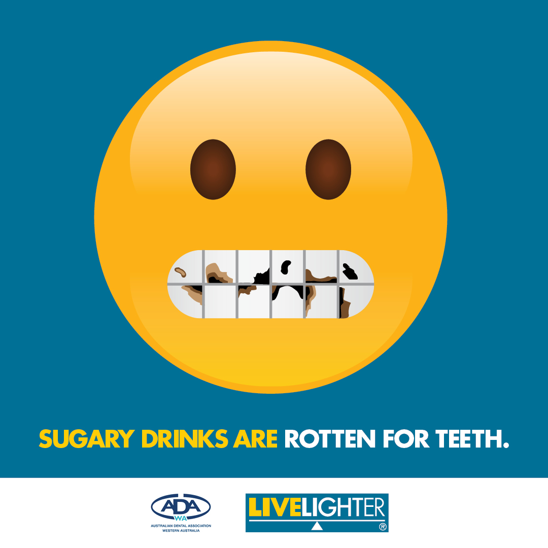 Sugary drinks are rotten for teeth