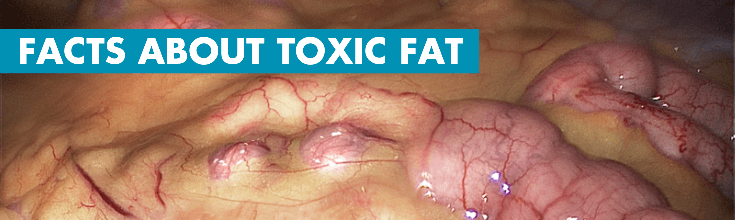 Facts about toxic fat