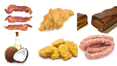 Examples of saturated fats - bacon, crossiant, choclate bar, coconut oil, chicken nuggets and sausages